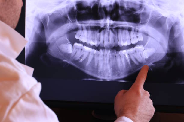 Best Emergency Tooth Extraction in Palouse, WA