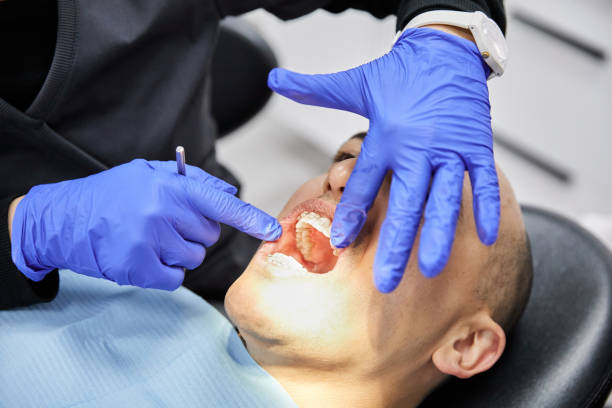 Best Urgent Care for Lost Fillings or Crowns in Palouse, WA